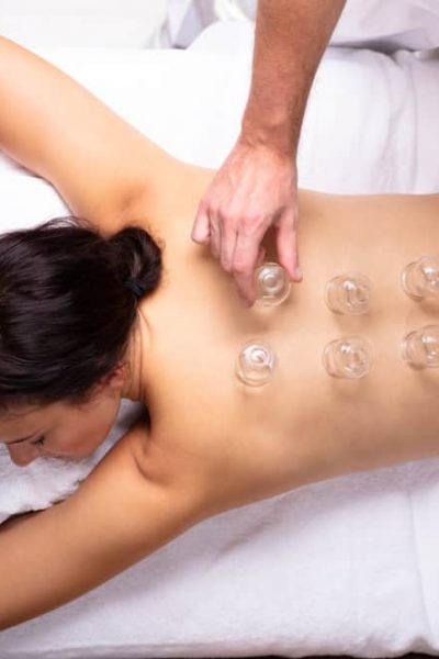 Relaxed,Young,Woman,Receiving,Cupping,Treatment,On,Her,Back,In